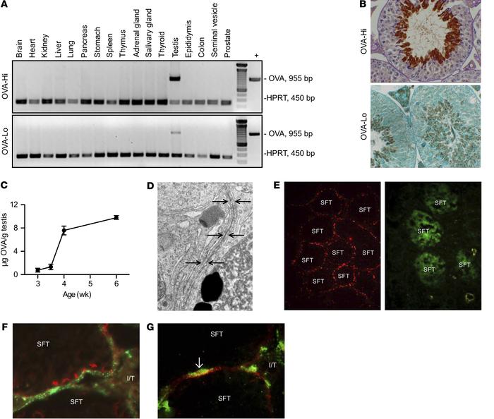 Testis-specific transgenic OVA expressed in elongated spermatids as a su...