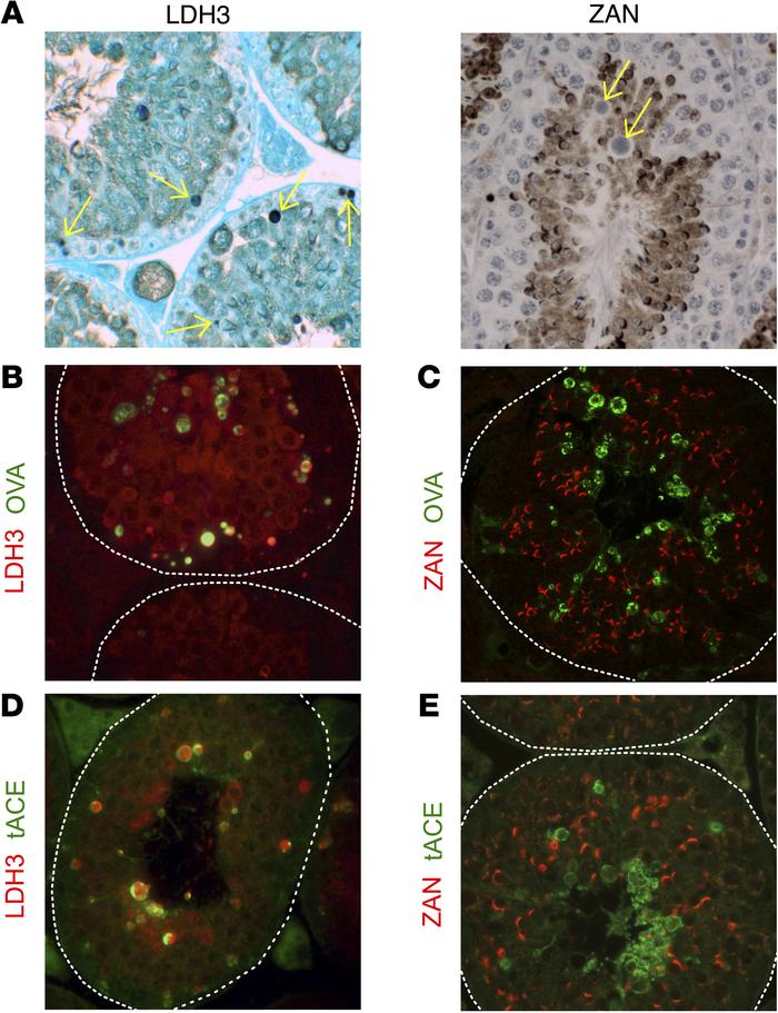 Detection of LDH3 and ZAN in residual bodies of both OVA-Hi and BALB/c m...