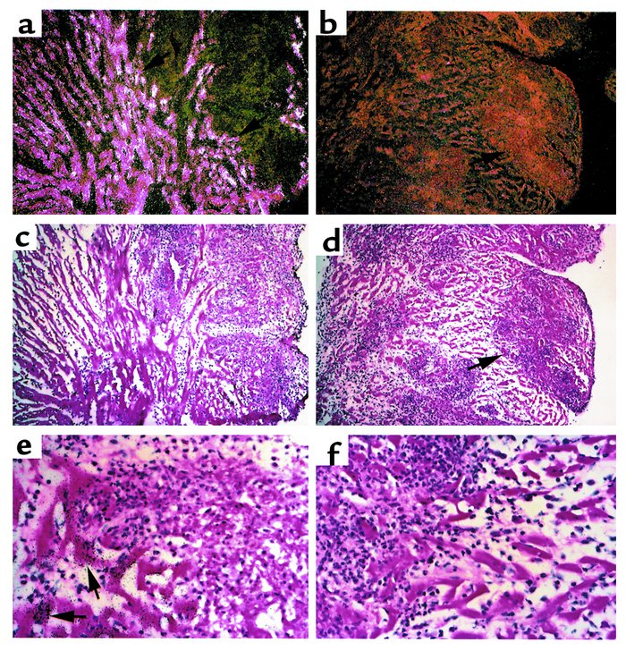 Myocarditis induces apoJ mRNA in wild-type, but not apoJ-deficient, mice...