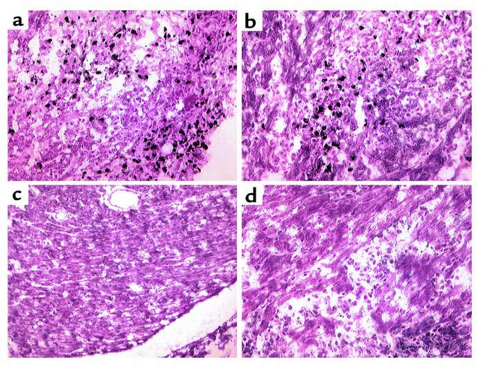 Induction of cardiac MHC-II is similar in apoJ-deficient and wild-type m...