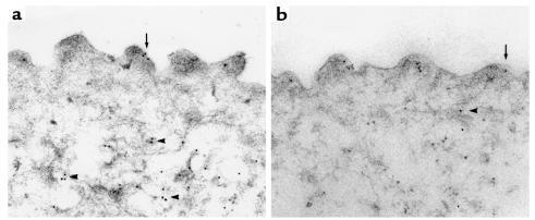 Immunoelectron microscopical localization of AQP2 in IMCD principals cel...