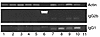 RT-PCR of spleen mRNA for IgG1 and IgG2a sterile transcripts. Lanes 1–3, Lo