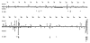 Pooled mutation analysis of all the clones obtained from the IgG VHBW-16 cD