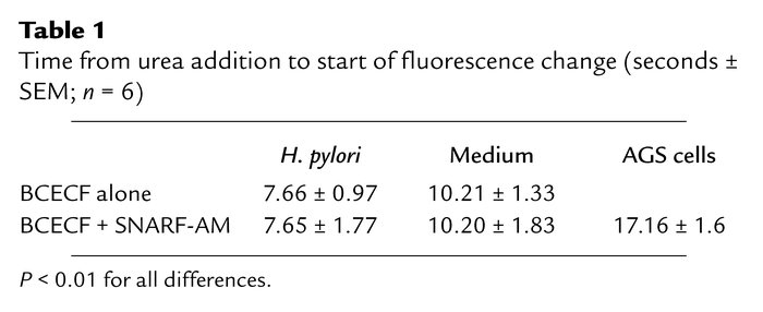 Time from urea addition to start of fluorescence change (seconds ± SEM; ...