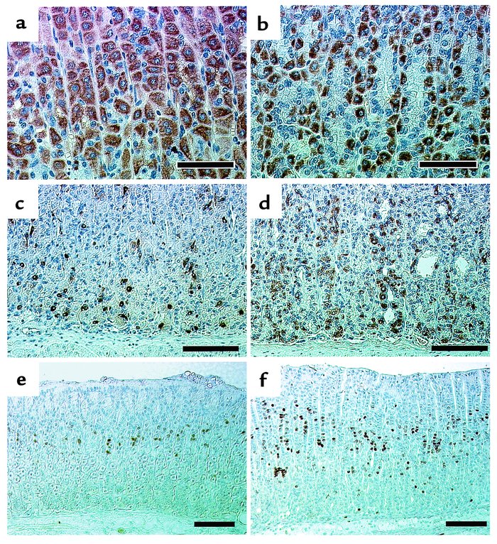 Immunohistochemical observation of gastric mucosa in H2R-deficient mice....