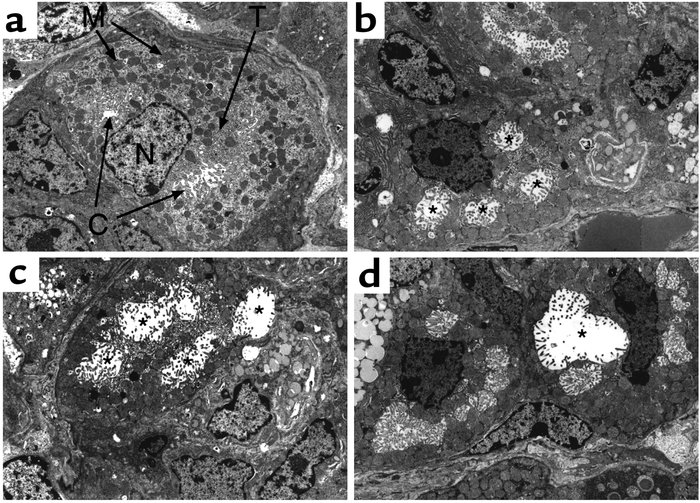 Ultrastructure of parietal cells in H2R-deficient mice. Electron microsc...