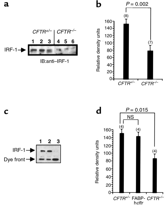 IRF-1 expression in CF and non-CF epithelial tissue. (a) Representative ...