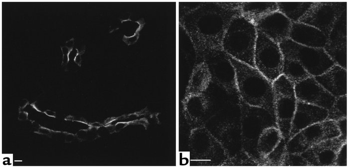 ANF stimulates plasma membrane insertion of AQP2 in kidney epithelial ce...