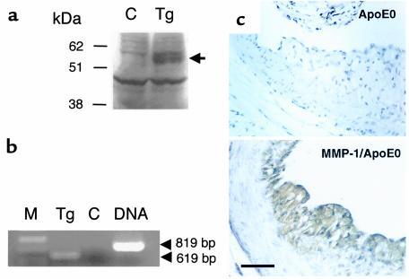 Presence of human MMP-1 in the atherosclerotic lesions of transgenic mic...