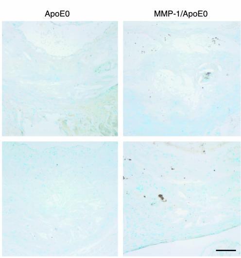 Immunohistochemical detection of cleaved type I collagen. Aortic section...