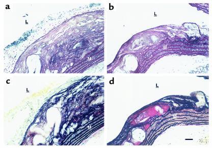 Comparison of atherosclerotic lesions after 25 weeks of the Western diet...