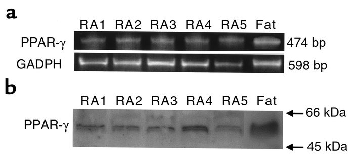 The expression of PPAR-γ mRNA and protein in cultured synoviocytes. (a) ...