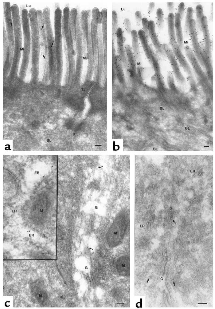 Ultrastructural localization of SI in biopsy specimens of CSID and a nor...