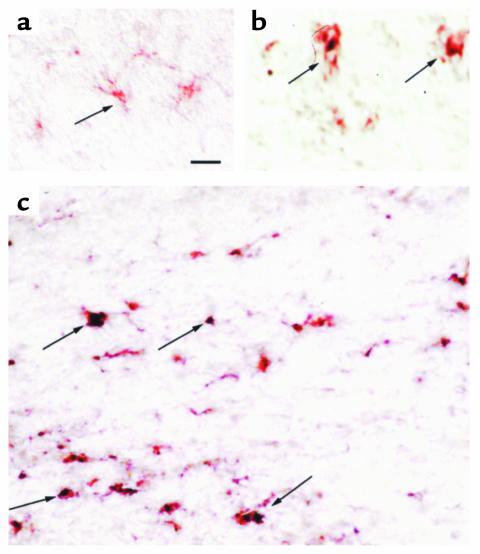 Cell distribution in brains injected with fluorescein-labeled NC mRNA an...