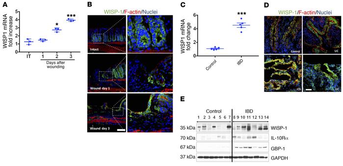 Colonic injury upregulates WISP-1 synthesis and secretion.
(A) WISP1 mRN...