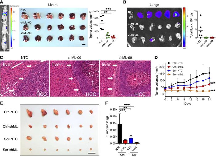 Knockdown of MTHFD1L suppressed HCC growth and sensitized HCC cells to s...