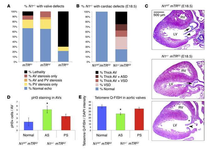 Disease severity in Notch1 mutants inversely correlates with telomere le...