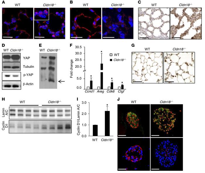 Activation of YAP signaling in whole lung and alveolar epithelial type I...