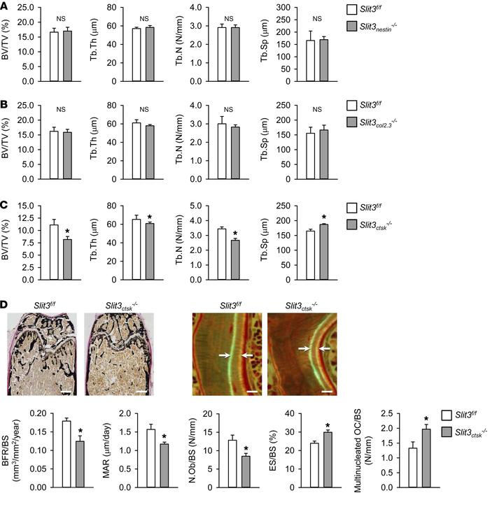 Osteoclast-derived SLIT3 is indispensable for normal bone mass in vivo.
...