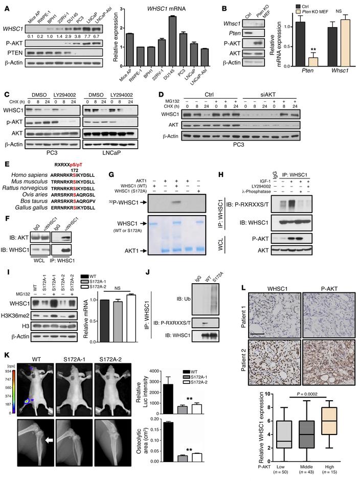 AKT phosphorylates WHSC1 at the S172 site to stabilize its protein in PC...