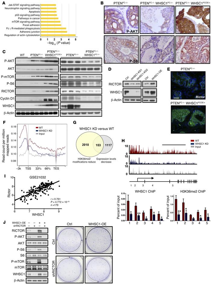 WHSC1 stimulates AKT signaling through direct regulation of RICTOR expre...