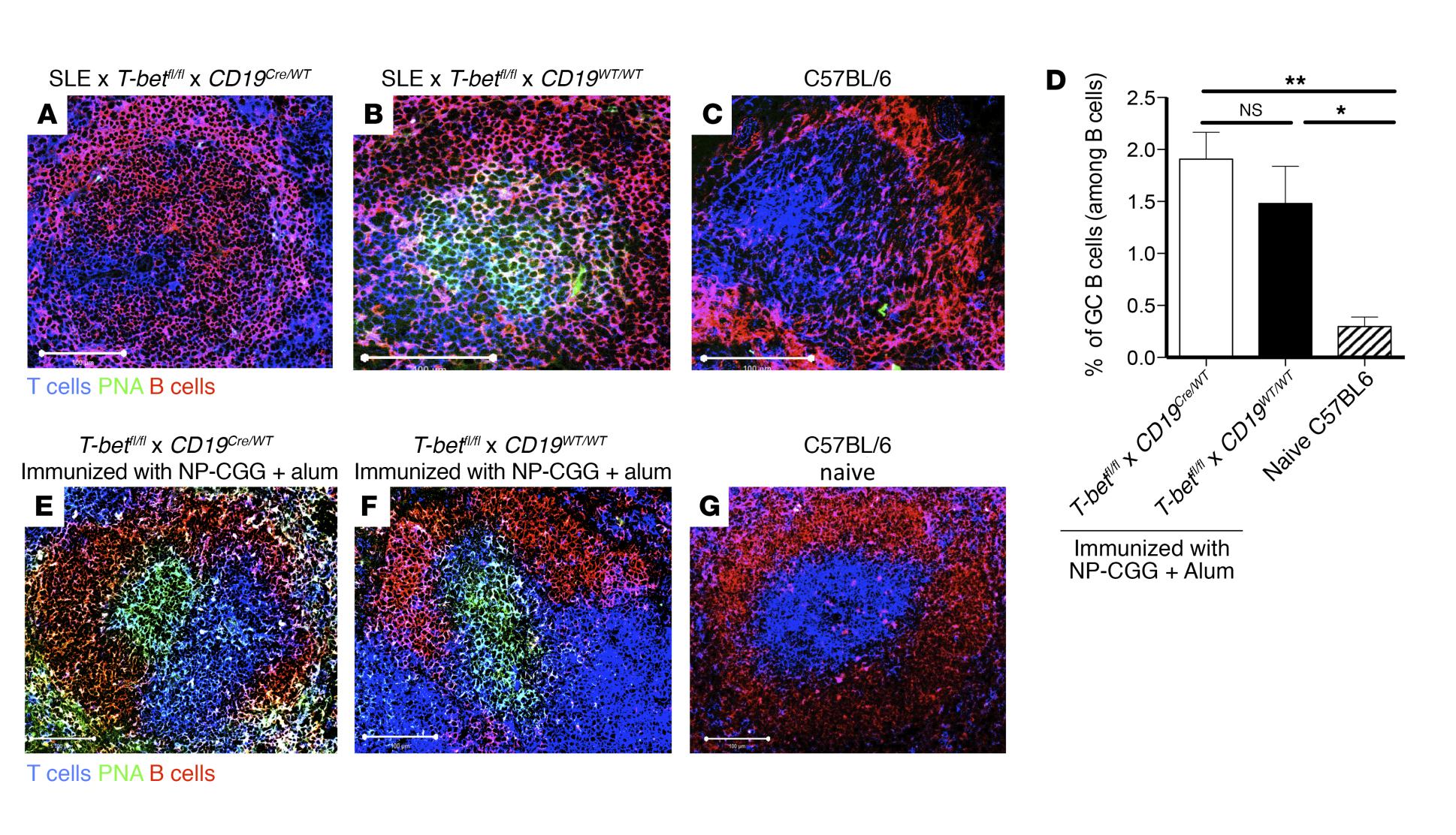 T-bet expression in B cells is required for the formation of spontaneous GCs, but is dispensable for the formation GCs following deliberate immunization. (A–C) Representative immunofluorescent staining of 5 spleen sections obtained from (A) SLE × T-betfl/fl × CD19Cre/WT, (B) SLE × T-betfl/fl × CD19WT/WT, or (C) C57BL/6 mice. (D) Percentage of GC B cells identified by FACS as B220+CD19+CD4–CD8–GL7+CD95+ and (E–G) representative immunofluorescent staining of spleens sections obtained from (E) T-betfl/fl × CD19Cre/WT, (F) T-betfl/fl × CD19WT/WT mice immunized with NP-CGG and alum (day 11) (n = 4 mice per group), or (G) naive C57BL/6 mice. n = 4 mice per group, representative of 3 independent experiments. Scale bars: 100 μm. *P < 0.05, **P < 0.01 by 1-way ANOVA followed by Newman-Keuls analysis. NS, not significant; PNA, peanut agglutinin.