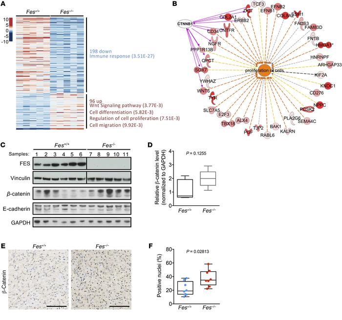 Wnt signaling is exacerbated in Fes-null mouse melanomas.
(A) Heat map s...