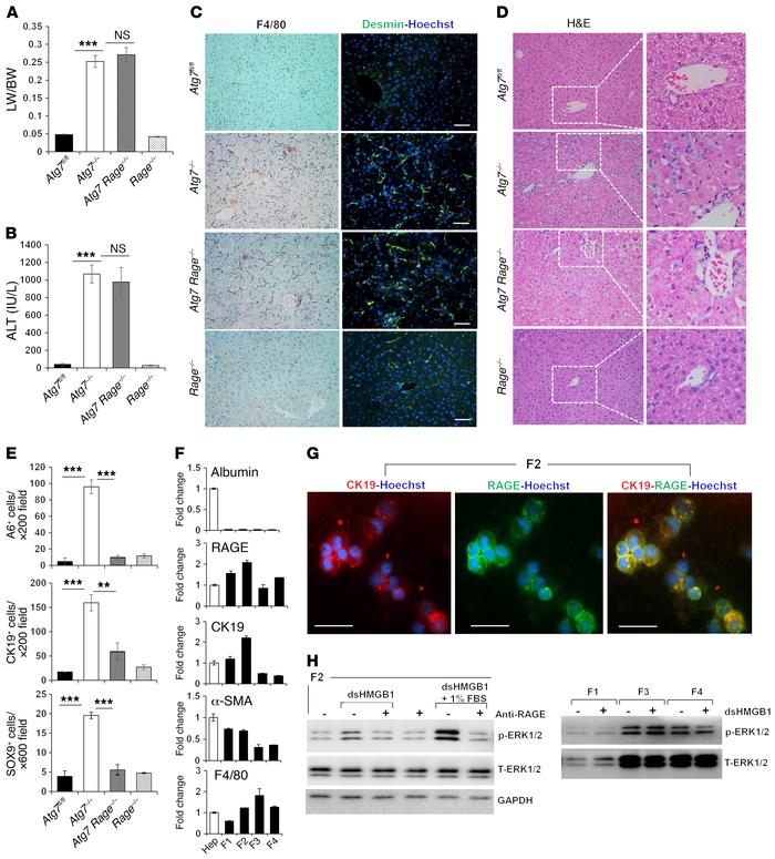 RAGE is required for DR in autophagy-deficient livers.
(A and B) LW/BW a...