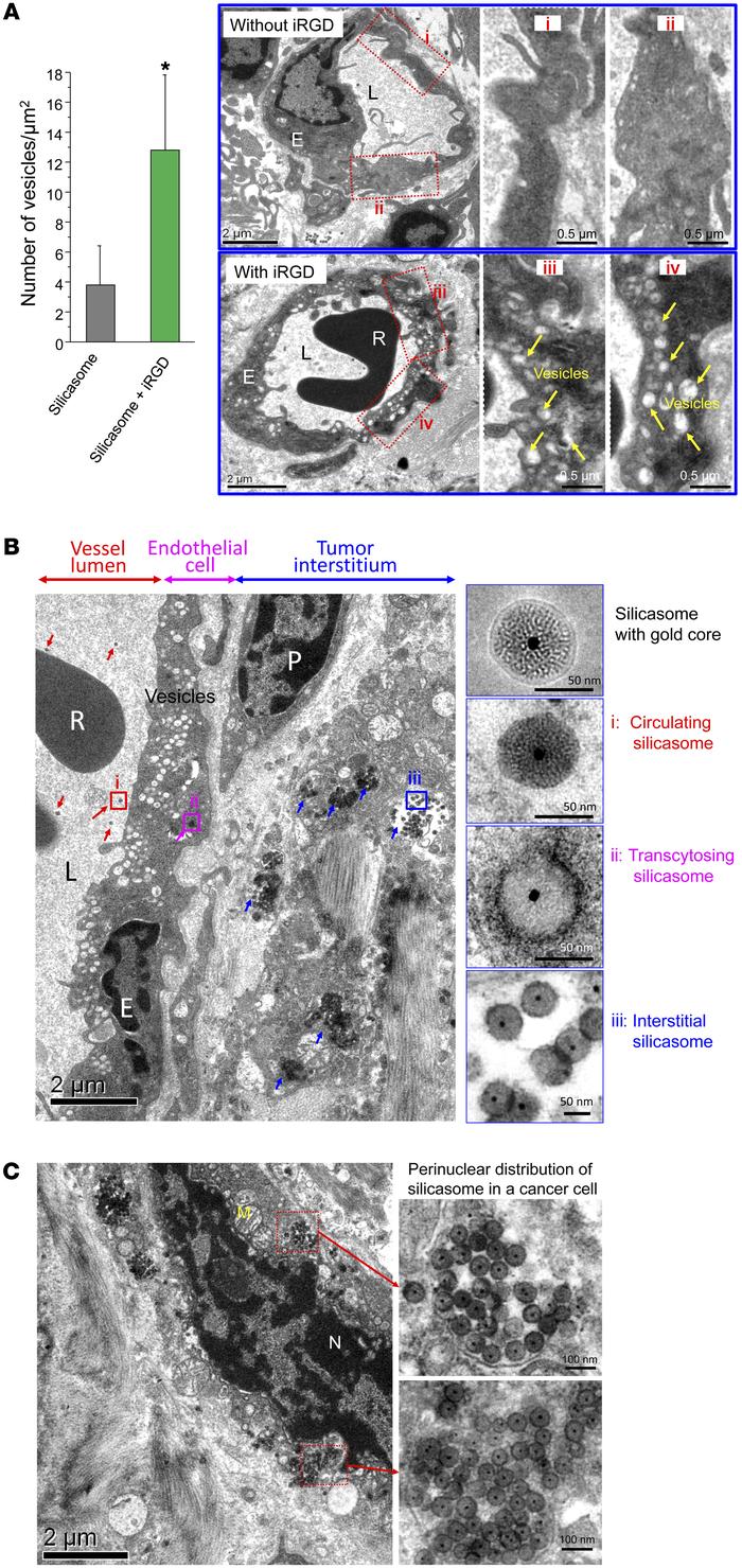 Ultrastructural viewing of the silicasome transport system initiated by ...