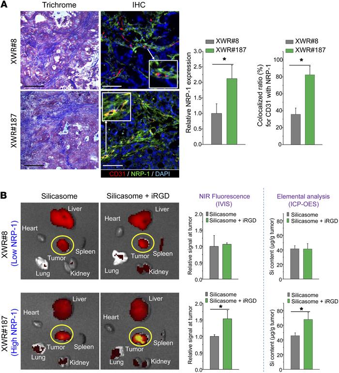 iRGD-induced silicasome biodistribution in patient-derived xenografts in...