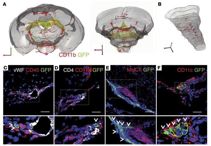 Transplanted NPCs distribute in the subarachnoid space within the inflam...