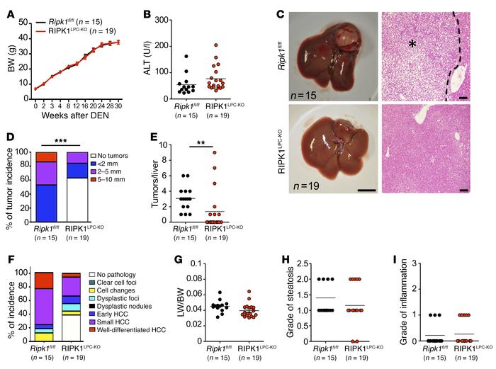 RIPK1 promotes DEN-induced liver tumorigenesis.
(A and B) Graphs depicti...
