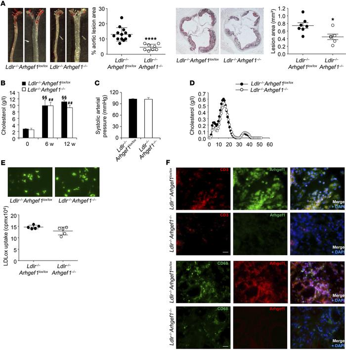 Deletion of the RhoA exchange factor Arhgef1 inhibits atherosclerosis.
(...