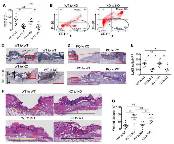 The influence of BM transplantation on inflammation and wound healing.
(...