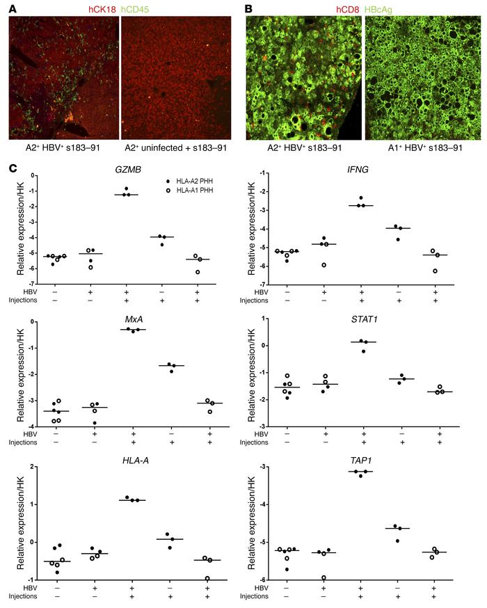 mRNA HBV–specific TCR–electroporated T cells are specifically recruited ...