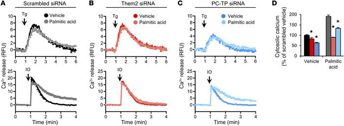 Them2 and PC-TP enable palmitic acid–induced calcium efflux from the ER....