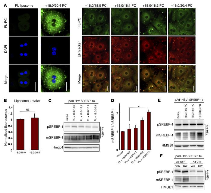 PC acyl chain composition regulates SREBP-1c processing.
(A) Analysis of...