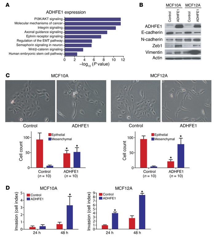 ADHFE1 induces epithelial-to-mesenchymal transition (EMT) and enhances i...