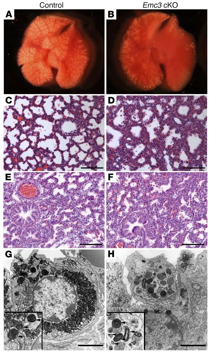 Surfactant deficiency and neonatal respiratory failure in Emc3-cKO mice....