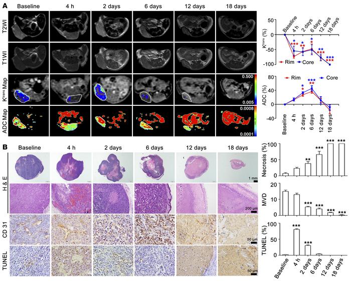 MRI monitoring of the vascular disruption effects of Z-GP-DAVLBH on MDA-...