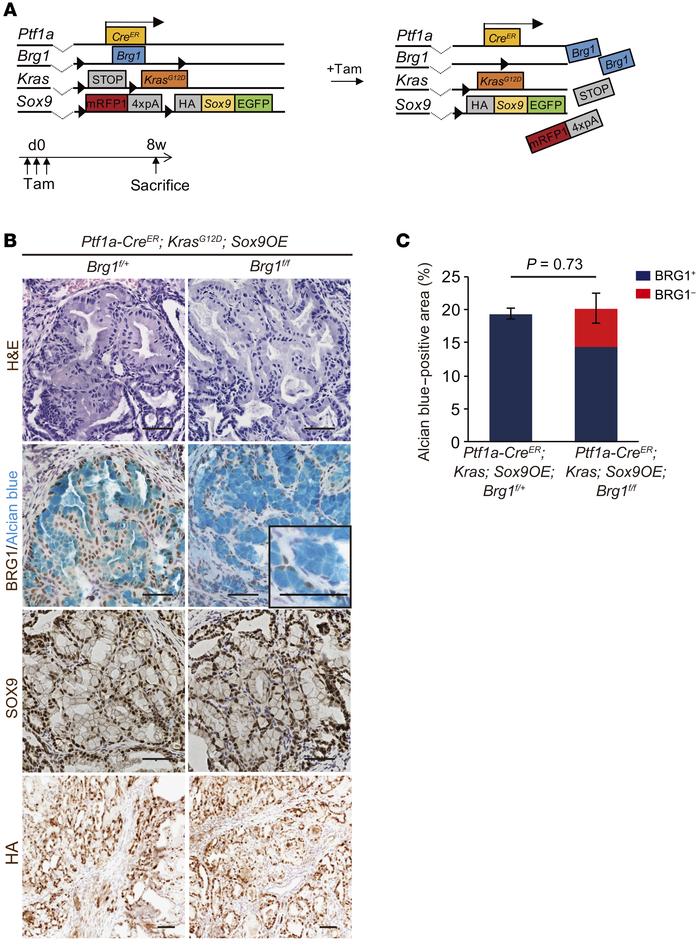 Sox9 overexpression cancels the decrease in KRAS-driven PanIN formation ...