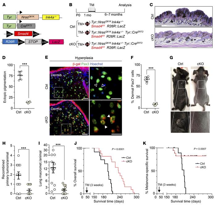 Conditional Smad4 deletion in a genetic mouse model of melanoma prevents...