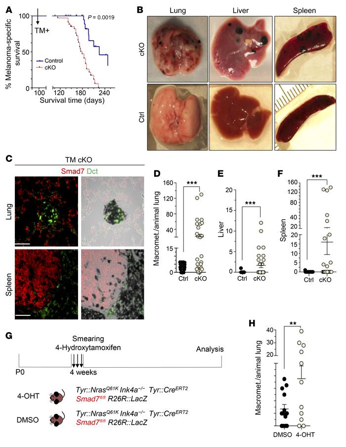 Reduced Smad7 expression promotes metastatic spread of melanoma in vivo....