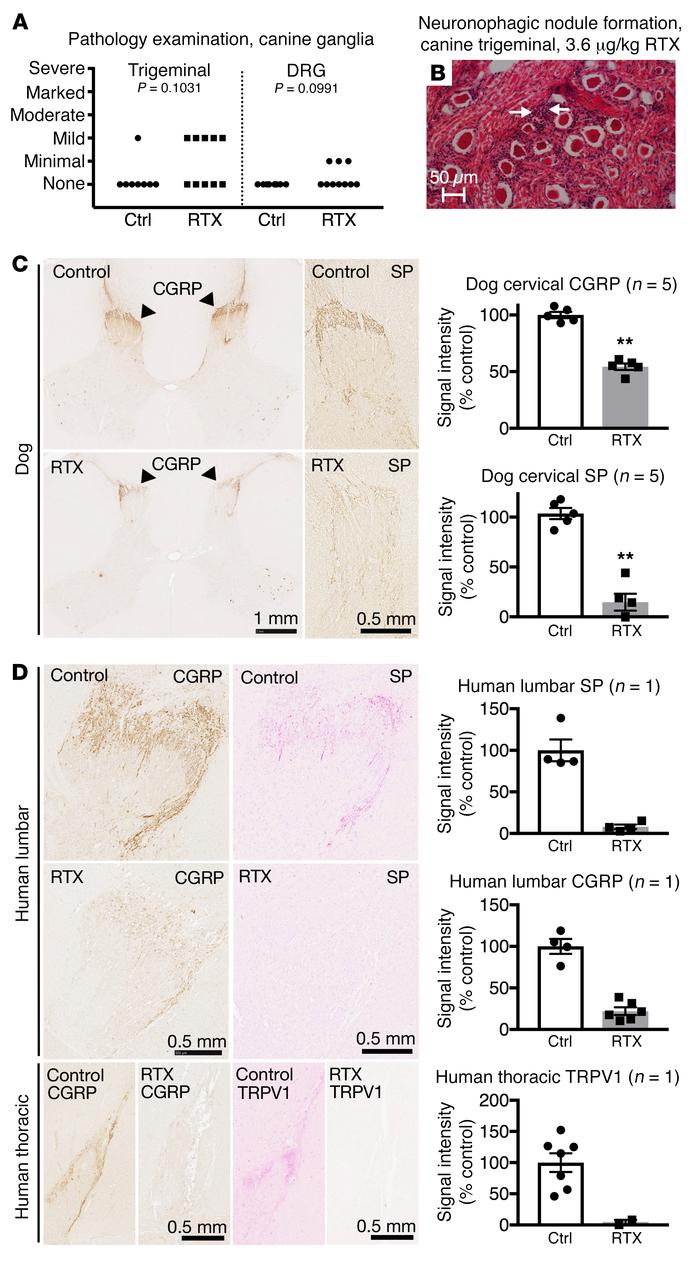 Immunohistochemical staining of DRG and spinal cord from human and canin...