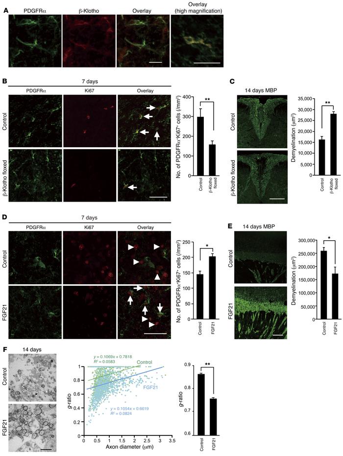 β-Klotho expression in OPCs is required for remyelination.
(A) Represent...
