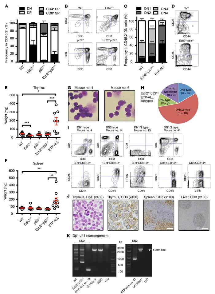 Ezh2 loss promoted the development of ETP-ALL in the absence of p53.
(A)...