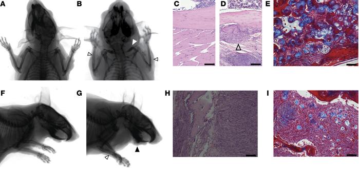 β-Catenin stabilization in bone progenitors promotes proliferation and b...