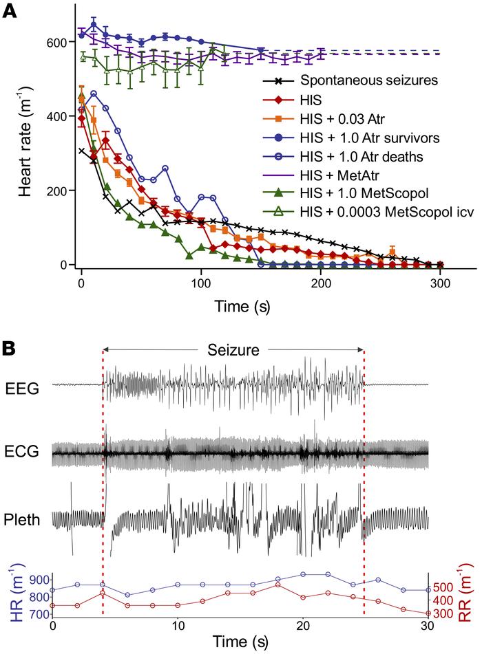 Postictal bradycardia is due to apnea, not increased parasympathetic dri...