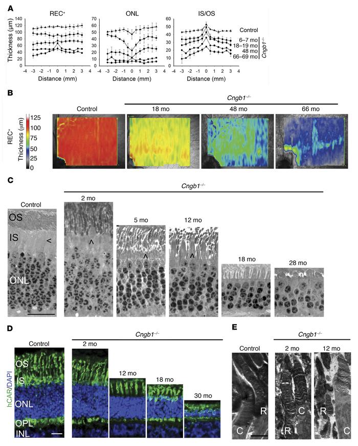 
Cngb1–/– dogs have a progressive retinal thinning with preservation of ...