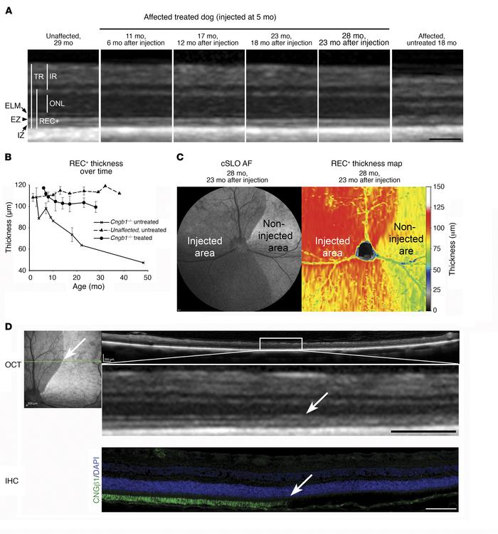 Retinal structure is preserved in gene therapy–treated retinal regions i...